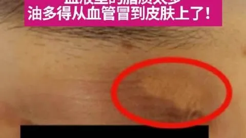 邯郸银行资本充足率触及1097临界点，盈利预警后台管理平台：拨备覆盖率不足109，亟需资本注入攻略